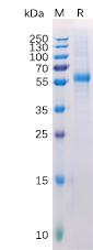 Recombinant Human LAG3 Protein with C-terminal 6Ã—His tag