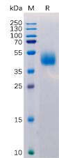 Recombinant Human MICB Protein with C-terminal 6Ã—His tag