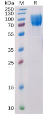 Recombinant human CD117 protein with C-terminal 6Ã—His tag