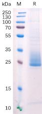 Recombinant human ANGPTL3 protein with C-terminal 6Ã—His tag