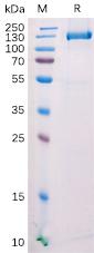 Recombinant mouse FAP protein with C-terminal mFc tag