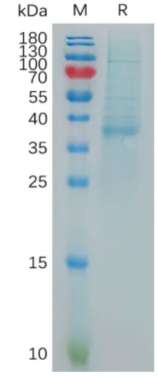 Recombinant human CXCL13 protein with N-terminal human Fc tag