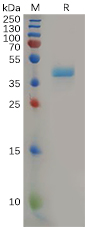 Recombinant human CCR8 protein with C-terminal human Fc tag