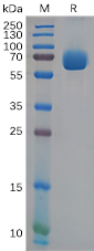 Recombinant Human Ephrin A Receptor 4/EphA4 (C-6His)