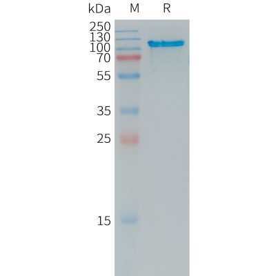 Human APLP2 Protein, His Tag