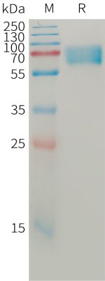 Human BACE1 Protein, His Tag