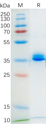 Recombinant Mouse GPRC5D Protein, hFc Tag