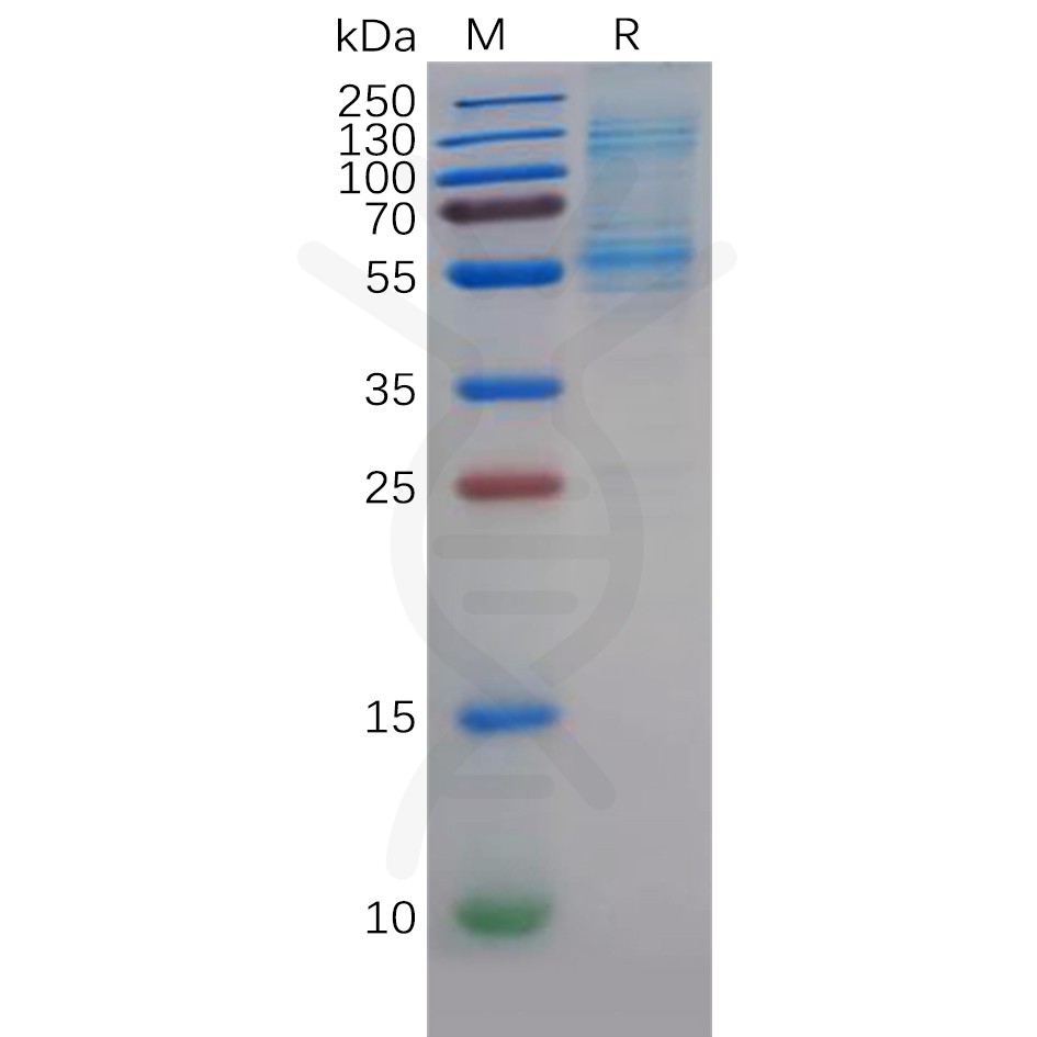 Recombinant Human DLL3 Protein, His Tag