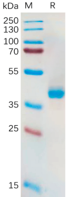 Recombinant Human SLC7A11 Protein, hFc Tag