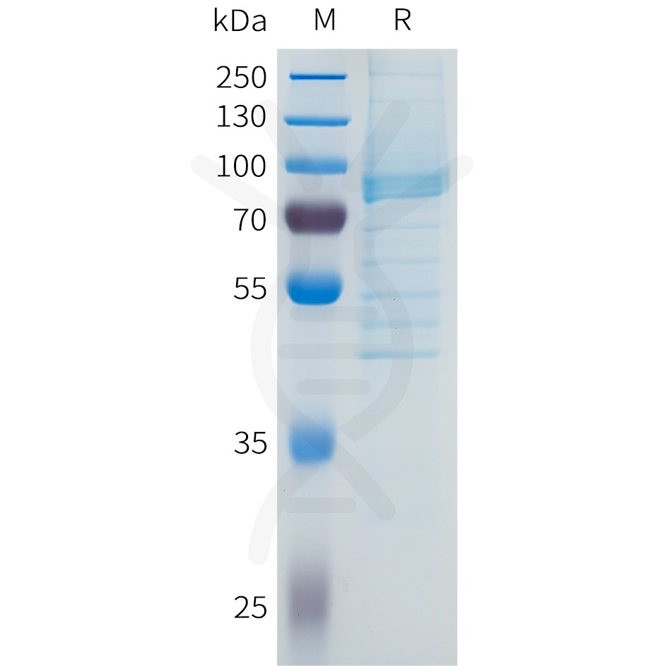 Recombinant Human DLL3 Protein, hFc Tag
