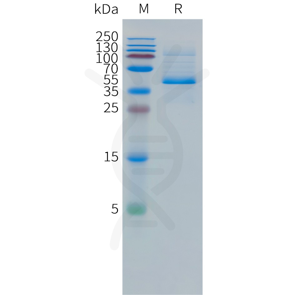 Human DLL3(352-492) Protein, hFc Tag