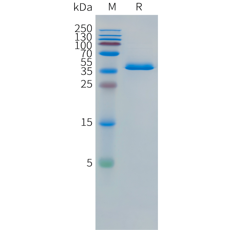 Human DLL3(390-492) Protein, hFc Tag Human DLL3(390-492) Protein, hFc Tag
