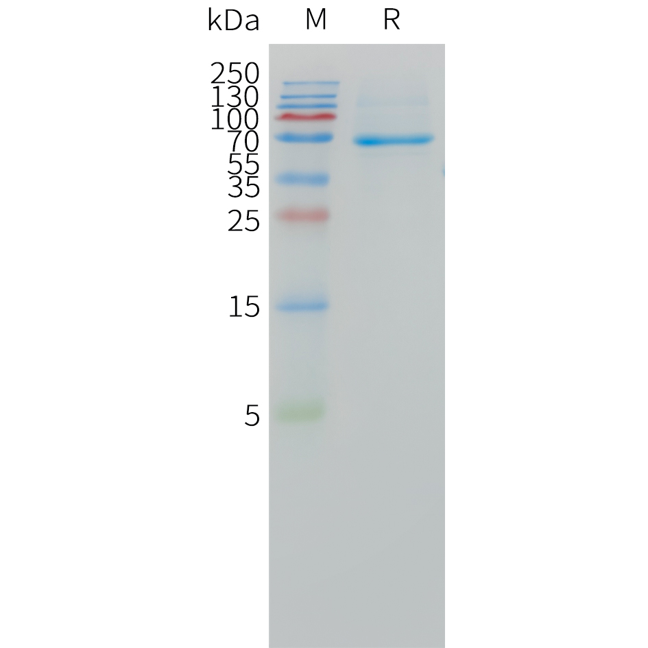 Human DLL3(311-492) Protein, hFc Tag Human DLL3(311-492) Protein, hFc Tag