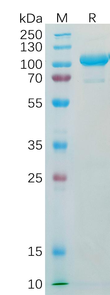 Human AFP Protein, hFc Tag