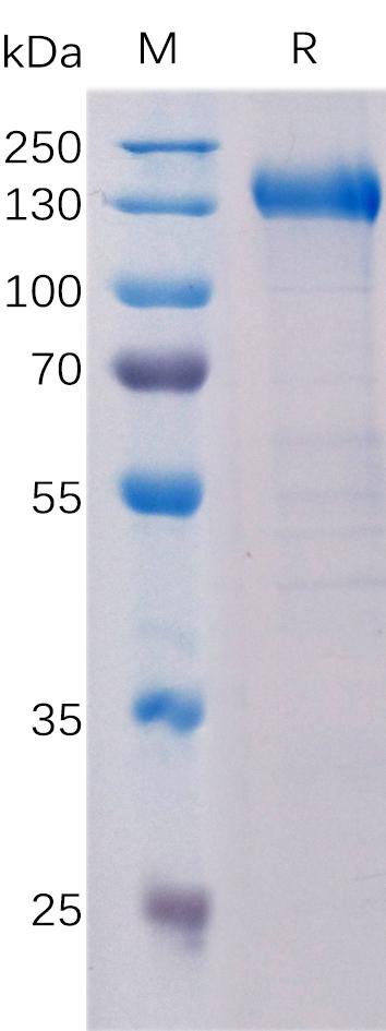 Human PTK7 Protein, hFc Tag