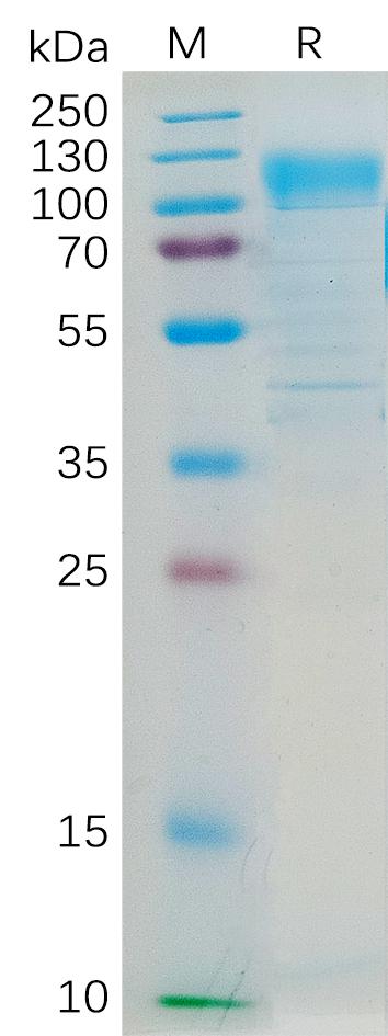 Human CD36 Protein, hFc Tag