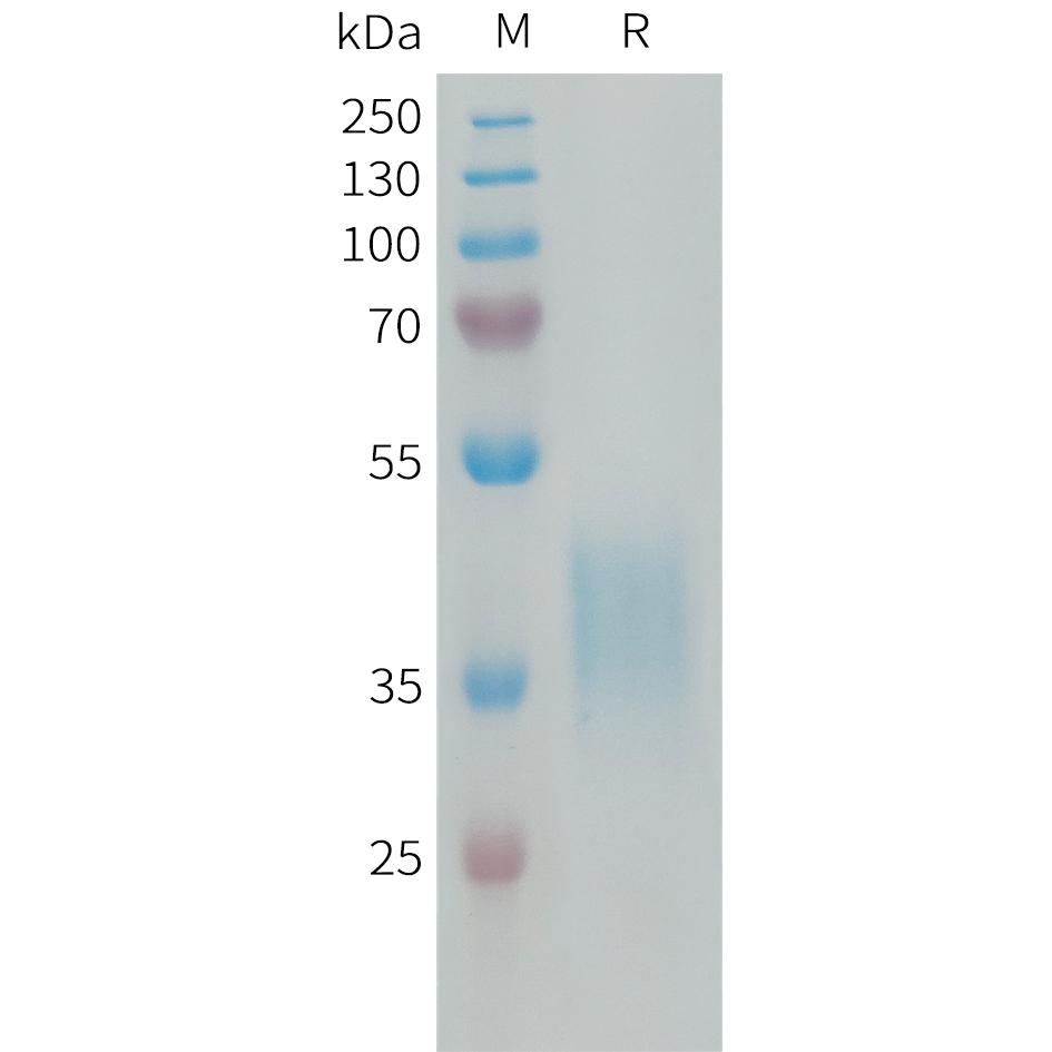 Human CRLF2 Protein, His Tag