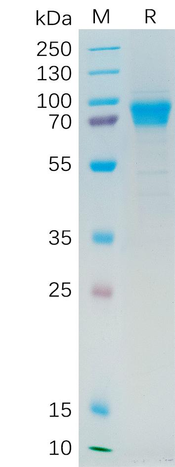 Human IL21R Protein, hFc Tag