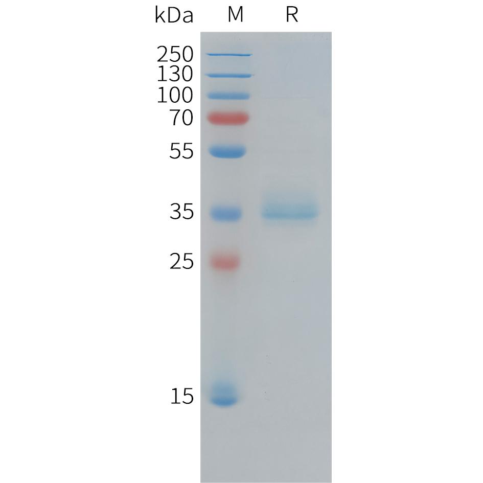 Human KI67(1206-1238) Protein, hFc Tag