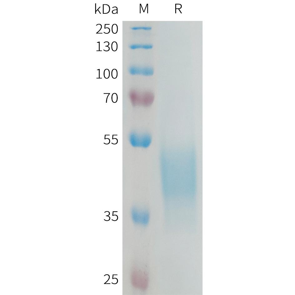 Human KIR2DL3 Protein, His Tag