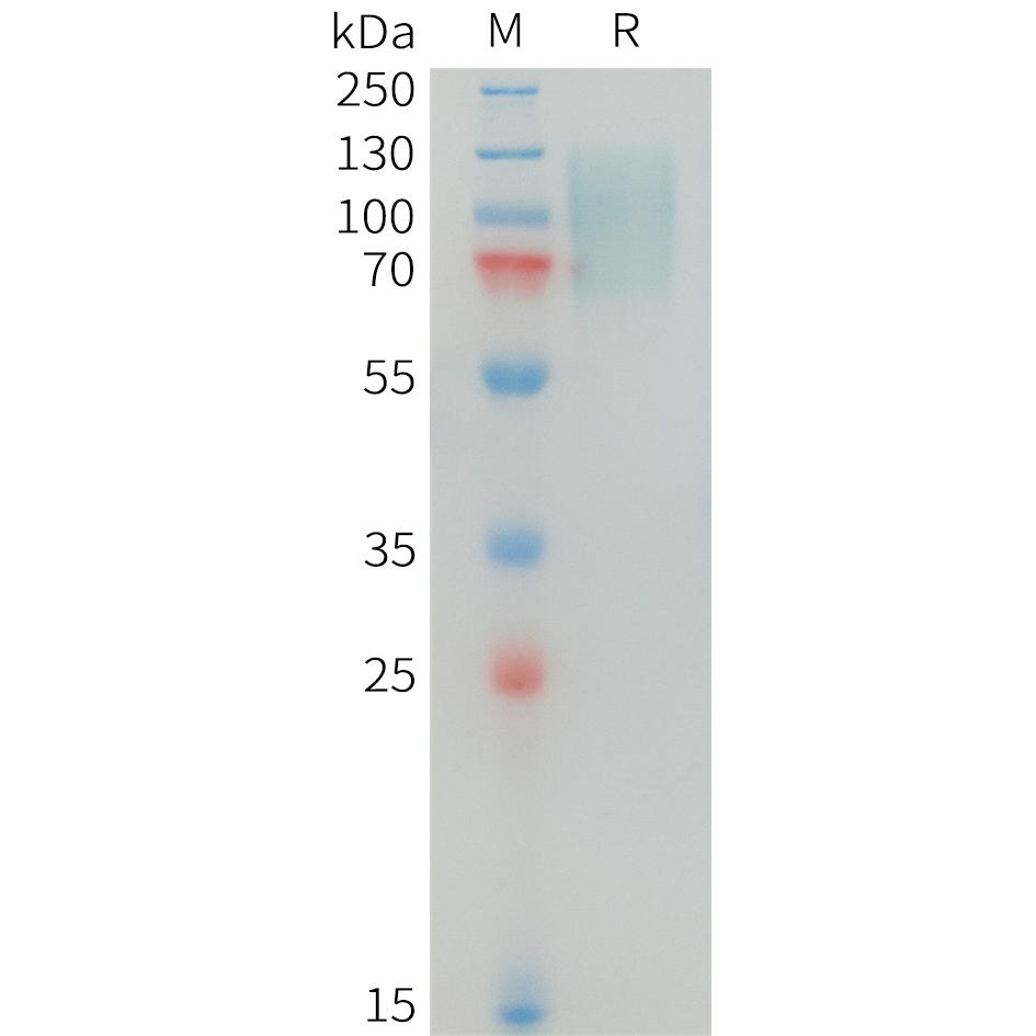 Human MERTK Protein, His Tag