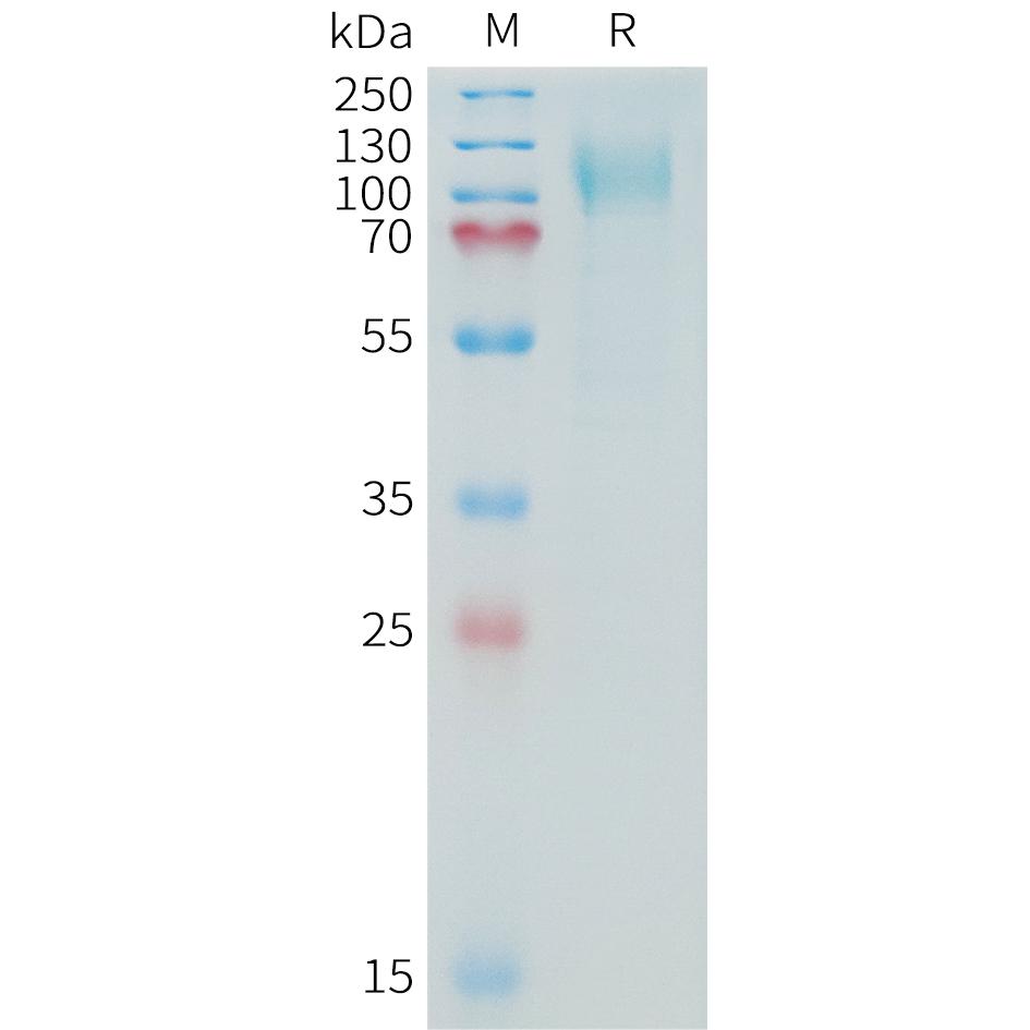 Human MUC16(13810-14451) Protein, His Tag