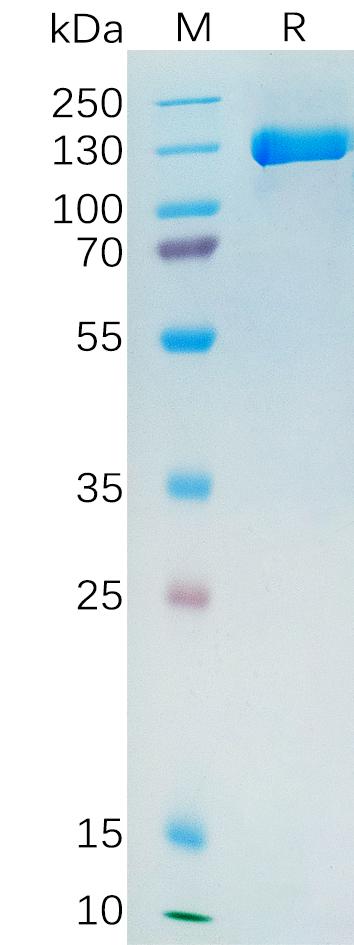 Human PSMA Protein, hFc Tag