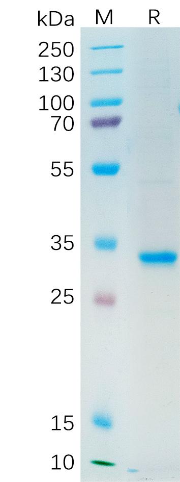 Human SFRP2 Protein, His Tag