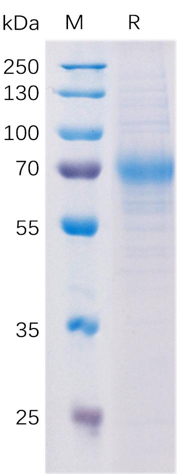 Human SLAMF3 Protein, His Tag