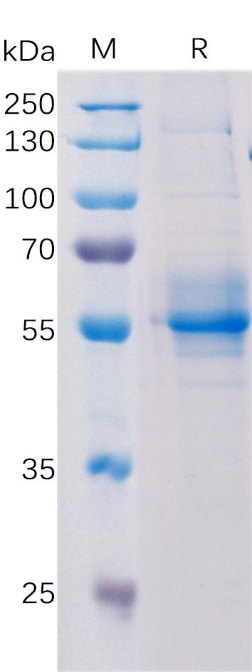 Human TMEM173 Protein, hFc Tag