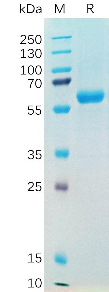 SARS-CoV-2 (Alpha) S protein RBD , hFc Tag