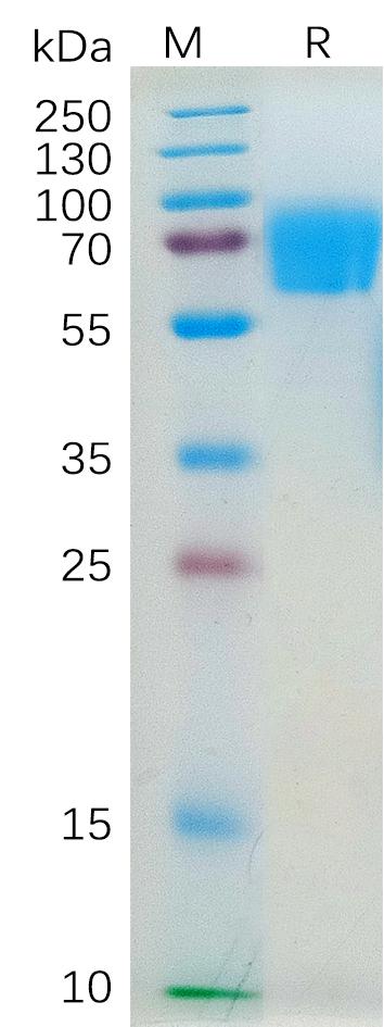 Human IL4RA Protein, mFc Tag