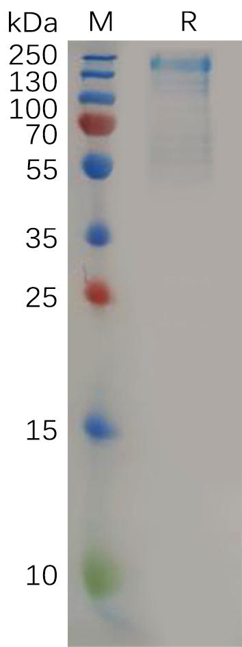 Human CD45 Protein, His Tag