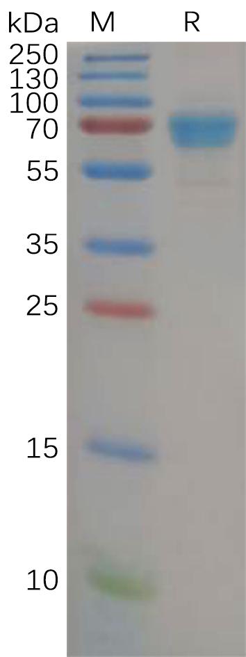 Human IL21R Protein, mFc Tag