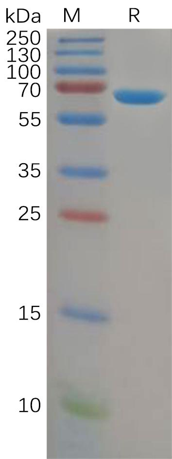 Human ALB Protein, His Tag