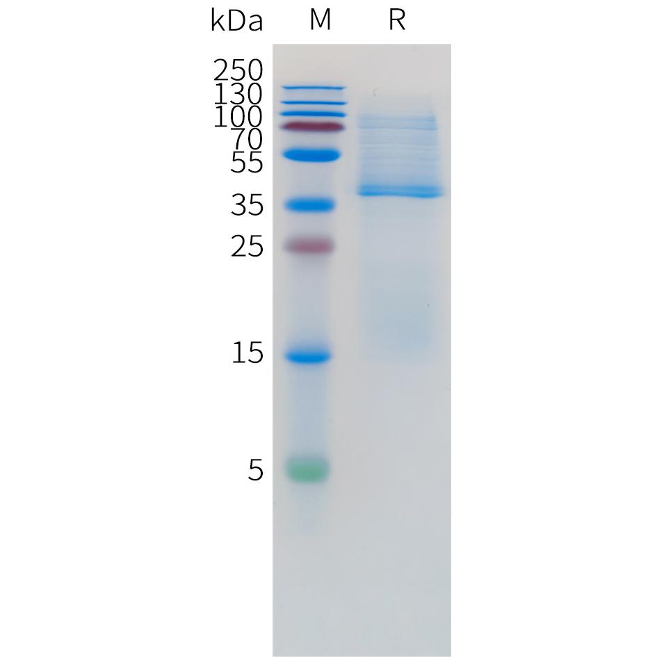 Human CD3D Protein, His Tag and Human CD3E Protein, hFc Tag