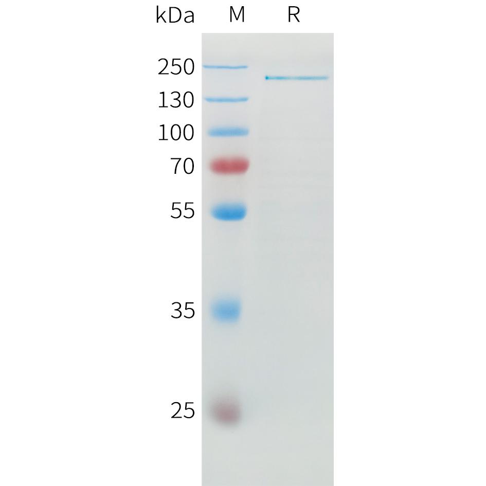 Human ADAMTS13 Protein, His Tag