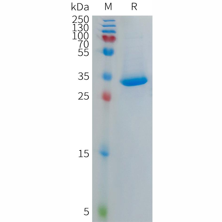 Human PF4V1 Protein, hFc Tag