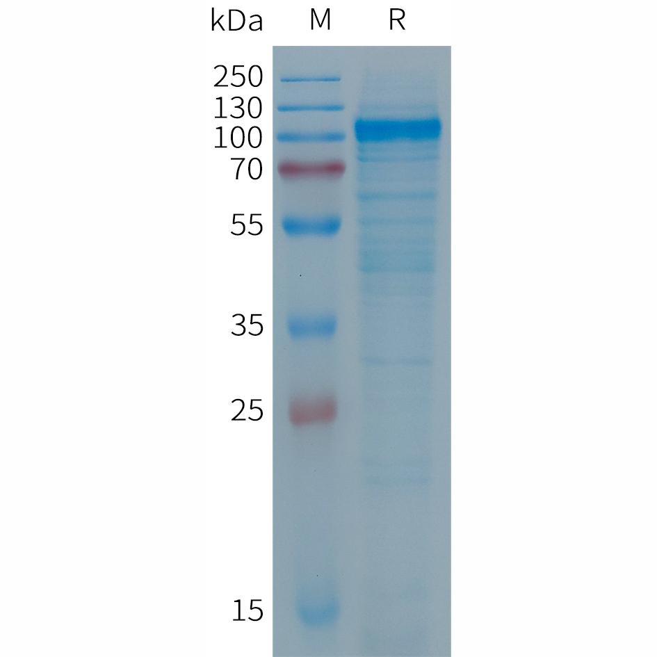 Human PTGFRN Protein, His Tag