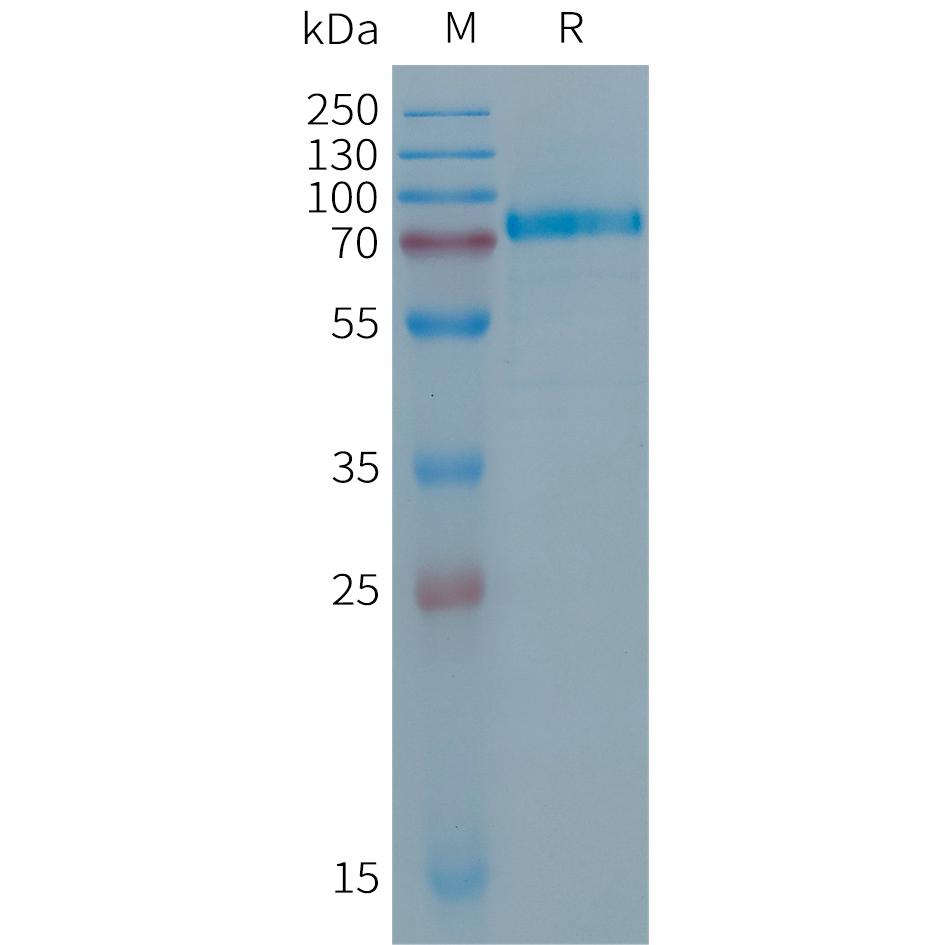 Human DSG2(50-609) Protein, His Tag