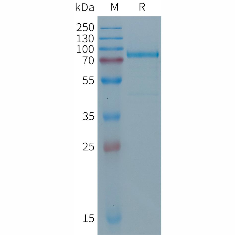 Human DSG2(24-609) Protein, His Tag