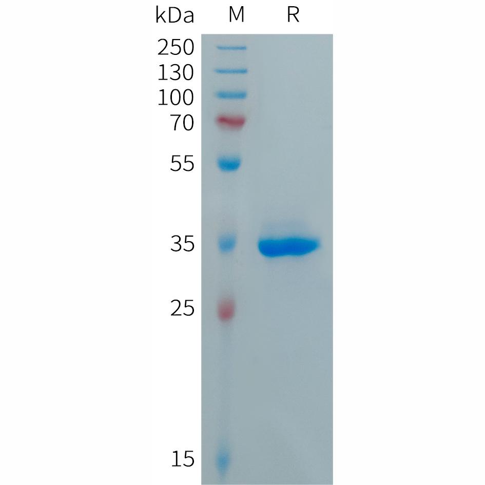 Human CXCL5 Protein, hFc Tag