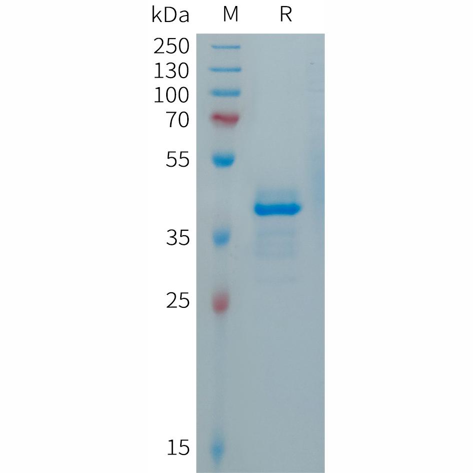 Human CALCA(26-141) Protein, hFc Tag