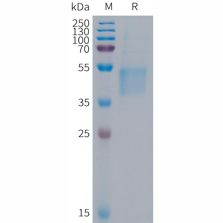 Human FSTL1 Protein, His Tag