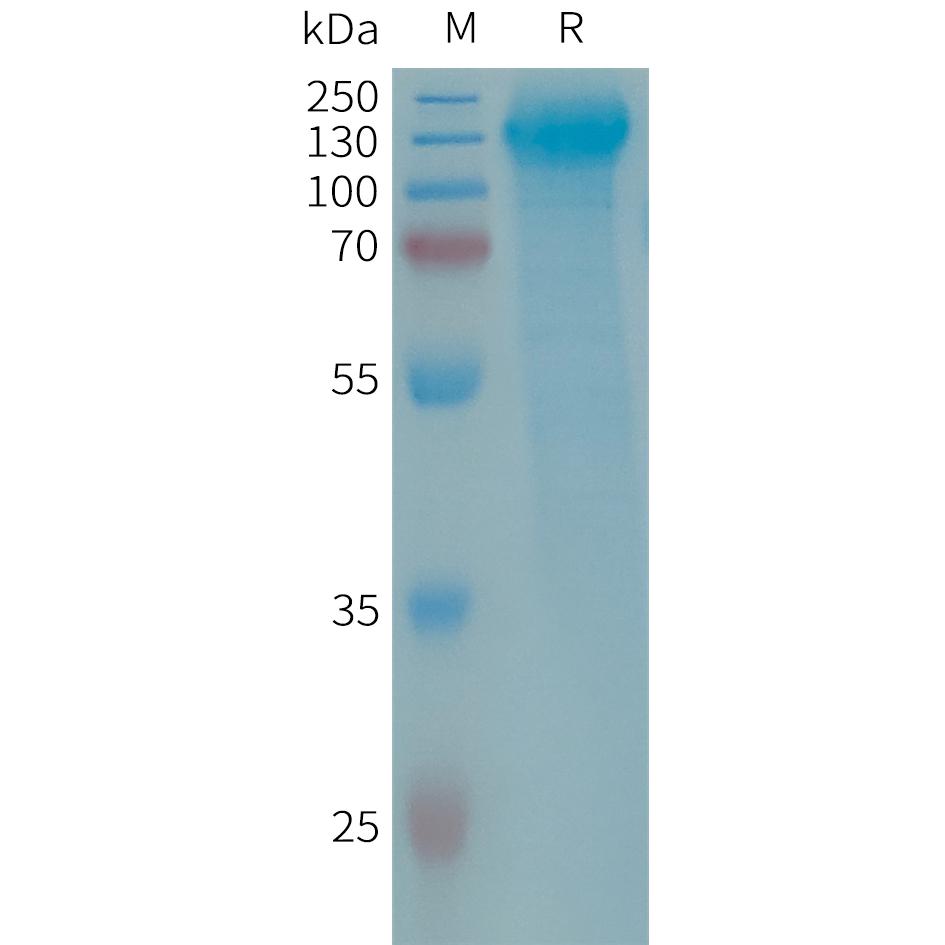 Human GPR64 Protein, His Tag