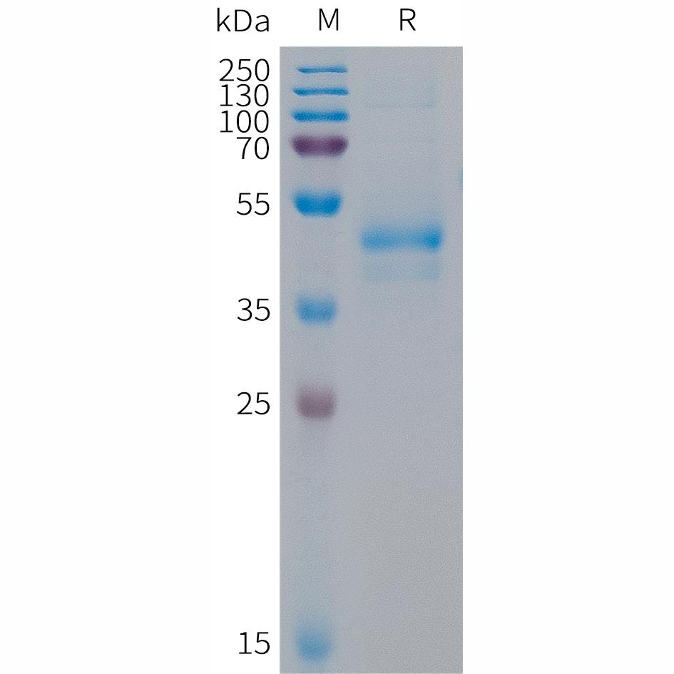 Human ARTN Protein, hFc Tag