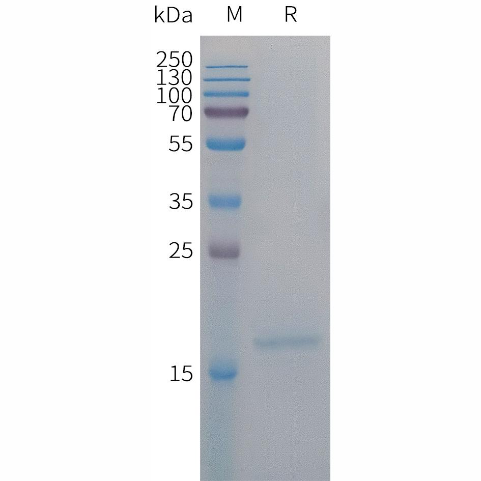 Human IL4 Protein, His Tag