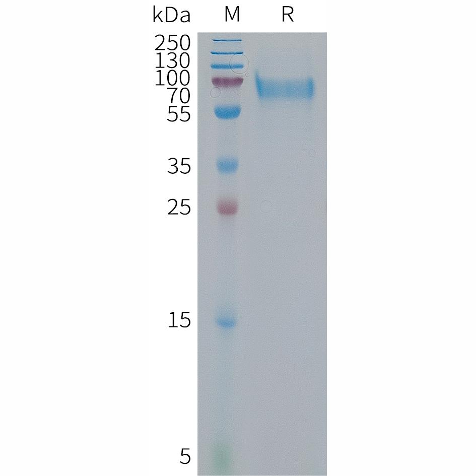 Human IBSP Protein, His Tag