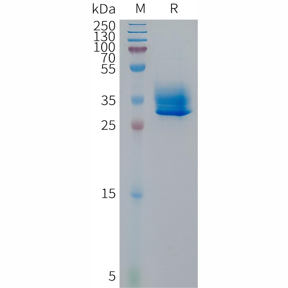 Human GPR81 Protein, hFc Tag