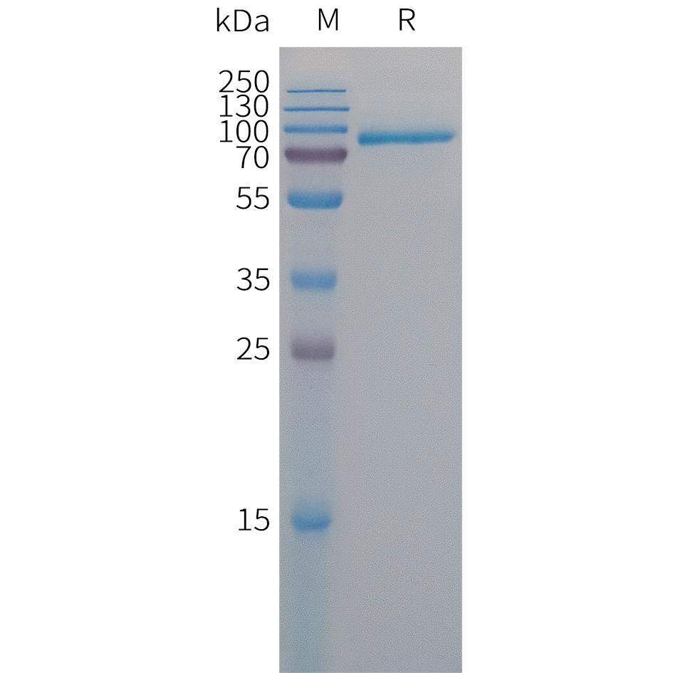 Human MELTF Protein, His Tag